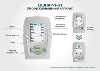 СКЭНАР-1-НТ (исполнение 01)  в Вологде купить Скэнар официальный сайт - denasvertebra.ru 